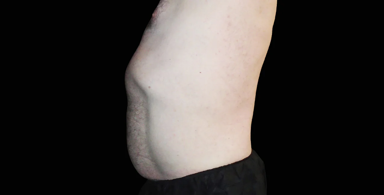 After image alt
