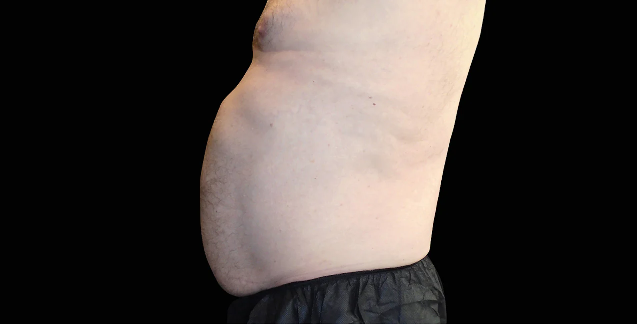 Before image alt